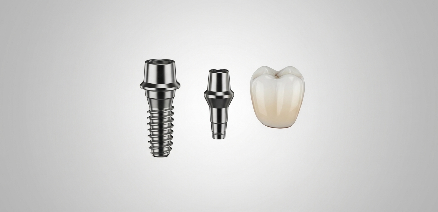 Dental Implant Fixture, Abutment, and Crown Components Dental Implants Cost is determined by the high-tech fixture, abutment, and crown.