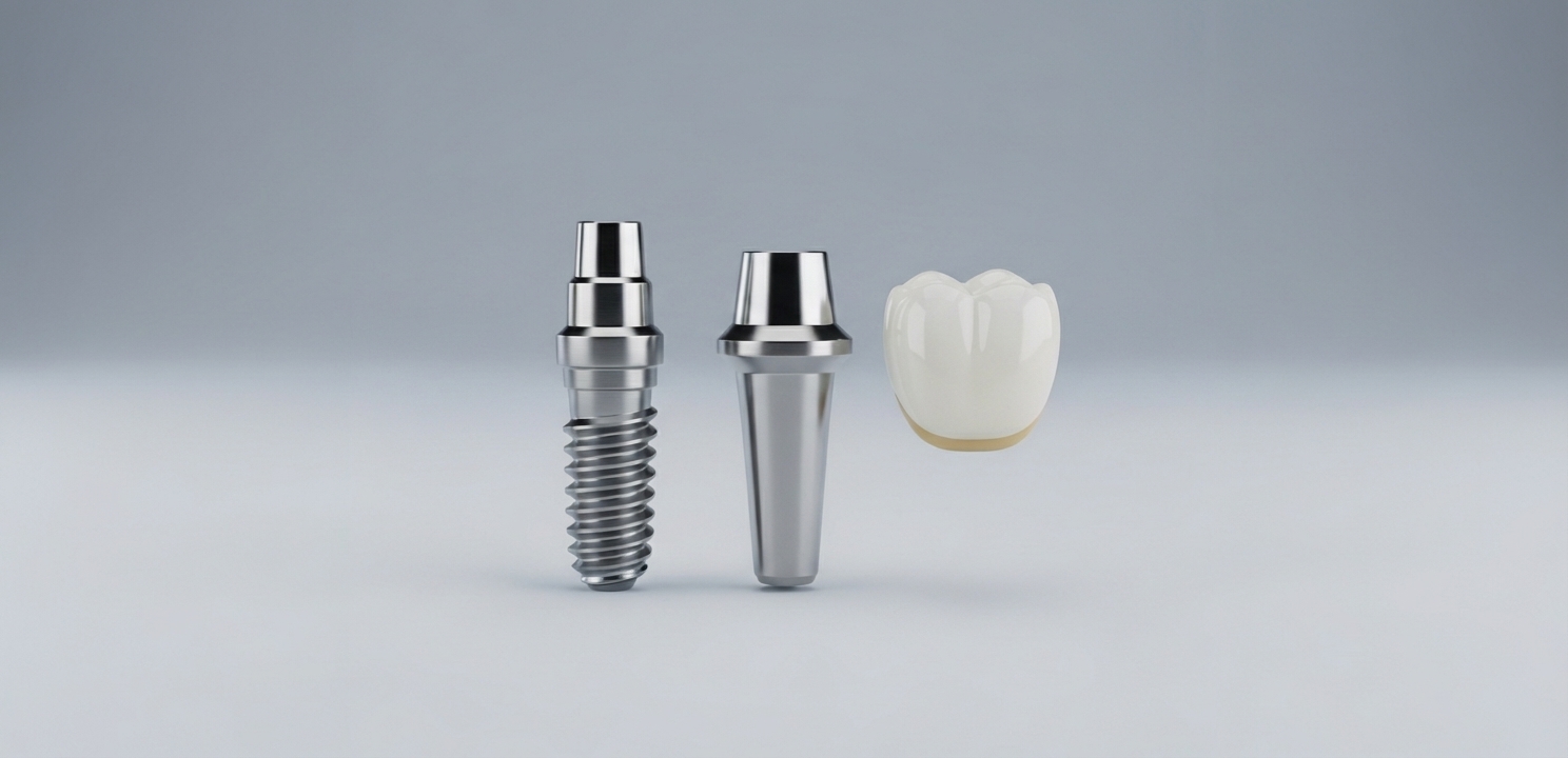 Dental Implant Structure: Post, Abutment, Crown Dental Implants are a sophisticated solution consisting of a post, an abutment, and a crown.
