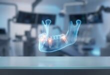 A photorealistic, close-up view of a glowing 3D digital model of a human jaw, illustrating the precise, angled placement of four dental implants in a modern, blurred laboratory setting.