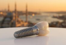 A photorealistic close-up of a modern dental implant on a clean surface, with the blurred background of the Istanbul skyline at sunset, symbolizing the fusion of dental care and tourism.