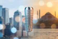 A photorealistic close-up of a titanium dental implant, with a split background featuring a blurred American city on one side and a warm, blurred view of Istanbul, Turkey on the other, representing a global comparison of dental treatment.