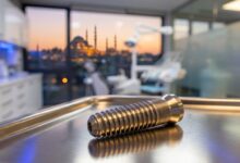 A close-up, photorealistic image of a single titanium dental implant screw on a sterile surface in a modern clinic, with a blurred view of a city skyline through a window in the background.