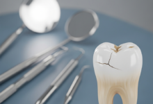 A photorealistic close-up of a human molar tooth with a subtle crack on its surface, set against a blurred background of a modern dental clinic with out-of-focus dental instruments.
