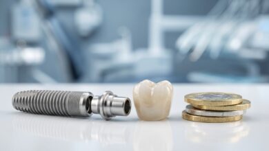 A close-up, detailed image of a dental implant's components—a titanium screw, an abutment, and a ceramic crown—placed next to a stack of British Pound coins on a clean, sterile surface.