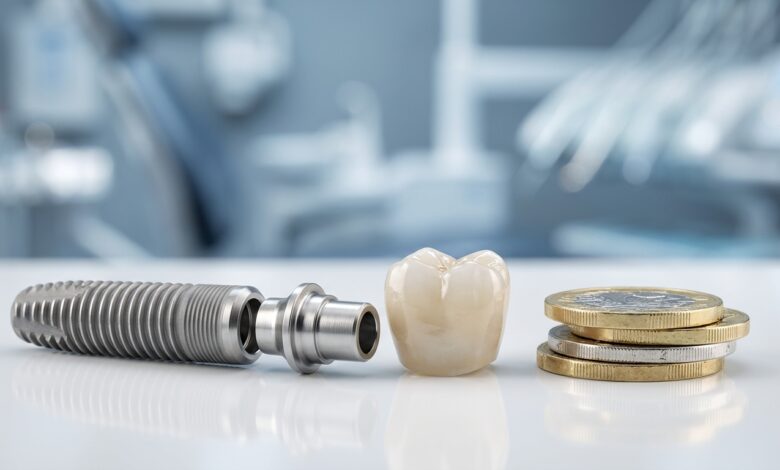 A close-up, detailed image of a dental implant's components—a titanium screw, an abutment, and a ceramic crown—placed next to a stack of British Pound coins on a clean, sterile surface.