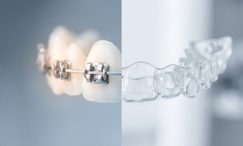 A photorealistic split image showing a close-up of a traditional metal brace on the left and a clear plastic aligner on the right, set against a clean, blurred background to represent the choice between orthodontic options.