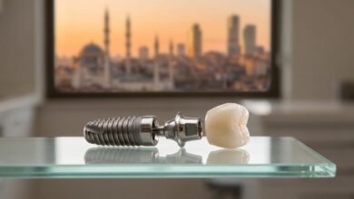 A photorealistic close-up of a complete dental implant model, including the titanium screw and porcelain crown, displayed on a sterile surface in a modern clinic. A blurred city skyline of Turkey is visible through a window in the background.