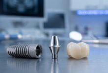 A highly detailed, photorealistic image showing the three parts of a single tooth dental implant—the titanium fixture, the abutment, and the ceramic crown—laid out on a clean surface in a modern dental setting.