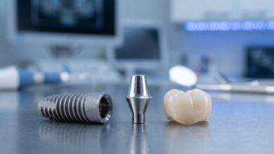 A highly detailed, photorealistic image showing the three parts of a single tooth dental implant—the titanium fixture, the abutment, and the ceramic crown—laid out on a clean surface in a modern dental setting.