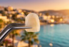 A close-up, photorealistic image of a perfect porcelain dental veneer held by professional tweezers, with the sunlit coast of Turkey beautifully blurred in the background.