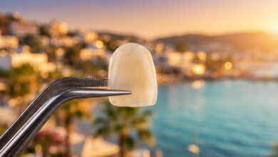 A close-up, photorealistic image of a perfect porcelain dental veneer held by professional tweezers, with the sunlit coast of Turkey beautifully blurred in the background.