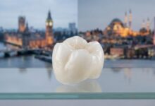 A close-up, photorealistic image of a perfect white dental crown, centrally focused. The background is softly blurred and split, with a UK landmark on one side and a Turkish landmark on the other, symbolizing the concept of dental tourism between the two countries.