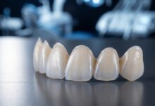 A close-up, photorealistic image showing several custom-made porcelain dental veneers resting on a dark surface in a clean, modern dental lab setting. The lighting emphasizes their realistic texture and translucency.