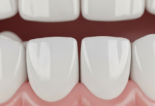 A close-up, photorealistic image of a healthy gum line and two pristine white teeth against a softly blurred, clean background, symbolizing oral health and wellness.