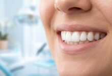 A detailed, photorealistic close-up of a person's incredibly bright, white, and healthy smile. The background is a softly blurred, modern, and clean professional setting.