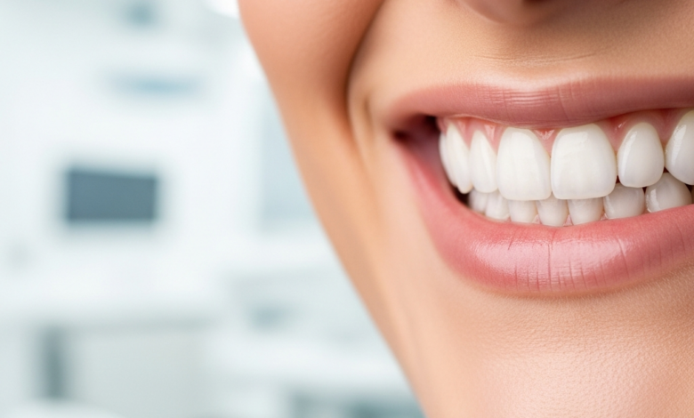 Close-up of a person smiling broadly, revealing perfect, bright white, natural-looking teeth, suggesting the results of dental veneers. The background is a soft, blurred image of a clean, modern dental office.