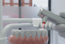 Close-up of a perfectly contoured gum line and healthy white teeth, with a blurred modern laser dental tool and indistinct UK city background, representing advanced cosmetic dentistry.