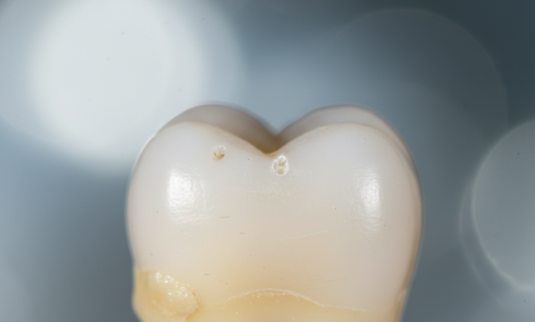 An extremely close-up, detailed photograph of a human tooth with noticeable plaque buildup and slight discoloration at the gumline, set against a blurred, neutral background.