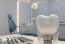 A photorealistic, close-up image of a conceptual, pristine dental implant or a perfect tooth model, representing advanced dental solutions. The background is a softly blurred, modern, clean dental clinic interior. The image uses cinematic lighting and shallow depth of field. There is no visible text or branding.