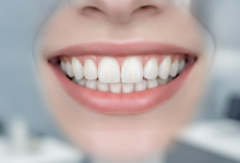 Close-up of a person's mouth with a brilliant, healthy, natural-looking smile, showing perfectly aligned white dental veneers on the upper front teeth. The background is softly blurred, depicting a clean, modern dental clinic interior, symbolizing cosmetic dentistry in the UK.