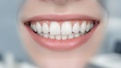 Close-up of a person's mouth with a brilliant, healthy, natural-looking smile, showing perfectly aligned white dental veneers on the upper front teeth. The background is softly blurred, depicting a clean, modern dental clinic interior, symbolizing cosmetic dentistry in the UK.