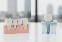 A photorealistic comparison of two dental models: a three-unit dental bridge on the left, showing crowns supporting an artificial tooth, and a single dental implant on the right, with a visible titanium post, abutment, and crown. Both are on a sterile surface in a modern dental clinic with a blurred UK city background.