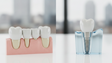 A photorealistic comparison of two dental models: a three-unit dental bridge on the left, showing crowns supporting an artificial tooth, and a single dental implant on the right, with a visible titanium post, abutment, and crown. Both are on a sterile surface in a modern dental clinic with a blurred UK city background.