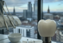 Close-up photorealistic image of a sterile dental implant with a white crown. The foreground is a blurred modern dental clinic, and the background shows a softly out-of-focus urban cityscape of Manchester.