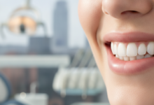 Close-up of a naturally bright, confident smile with perfectly whitened teeth, set against a softly blurred modern dental clinic interior and a distant, indistinct Manchester city skyline.