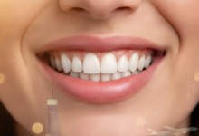 Close-up of a radiant, healthy, confident smile with perfectly restored, natural-looking teeth. The background is a soft, warm blur, subtly suggesting abstract global travel or distant city lights, evoking the concept of dental tourism. No text visible.