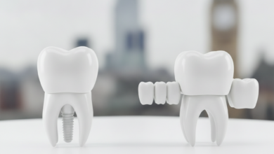 Two pristine, conceptual models representing dental solutions. On the left, a single, integrated tooth with a strong, root-like base symbolizes a dental implant. On the right, a dental bridge structure shows a replacement tooth supported by two crowned adjacent teeth. The background is a heavily blurred, out-of-focus UK cityscape, emphasizing the location context. The image is clean, professional, and free of any text.