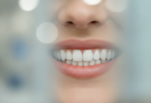 Close-up of a person's confident smile showcasing perfectly aligned, bright dental veneers in a blurred modern clinic background, no visible text.