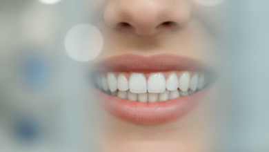 Close-up of a person's confident smile showcasing perfectly aligned, bright dental veneers in a blurred modern clinic background, no visible text.